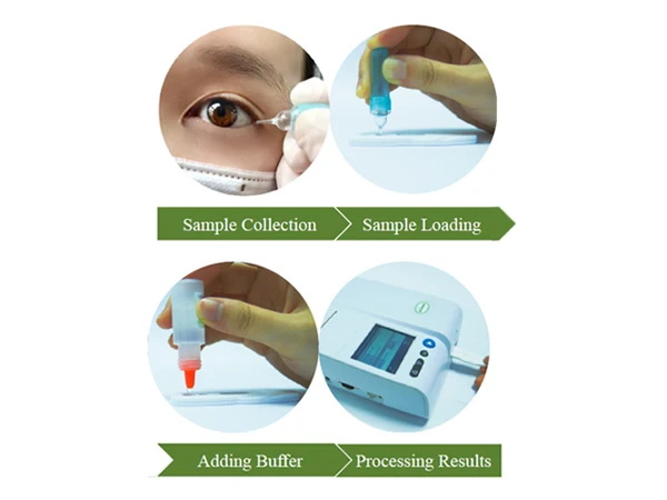 tear biomarker testing