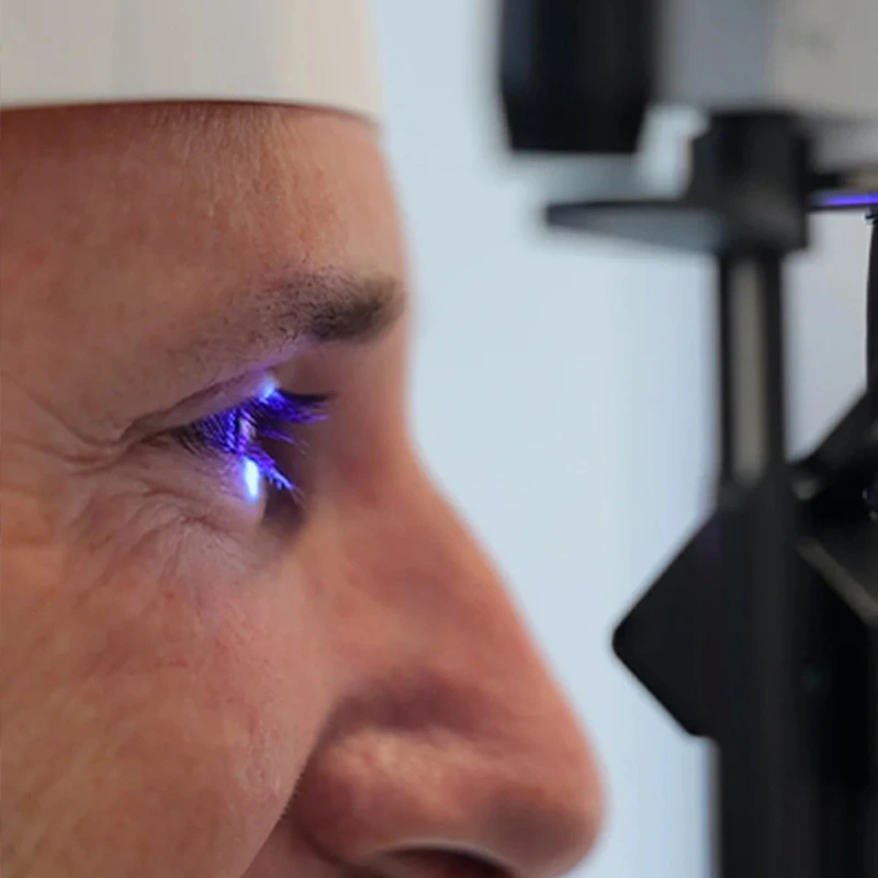 The Problem: Keratoconus and Ectasia