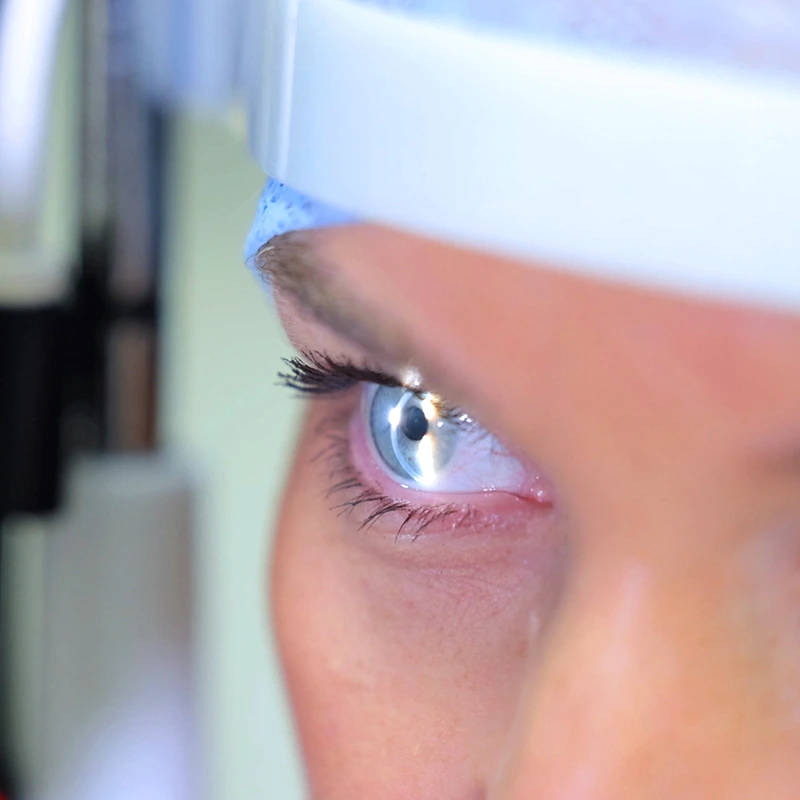 Benefits of Laser Eye Surgery