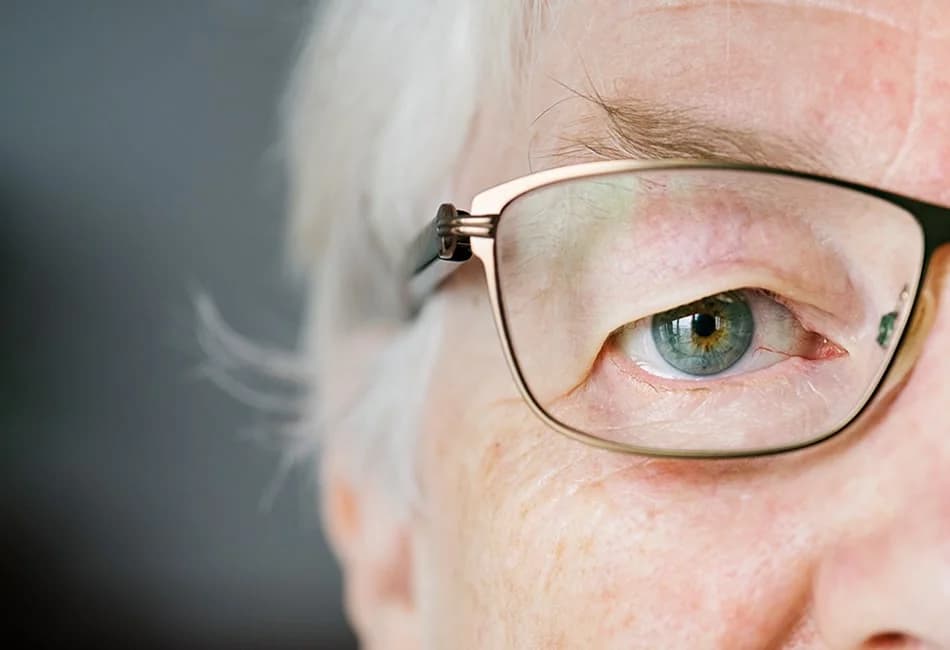 Cataract Surgery