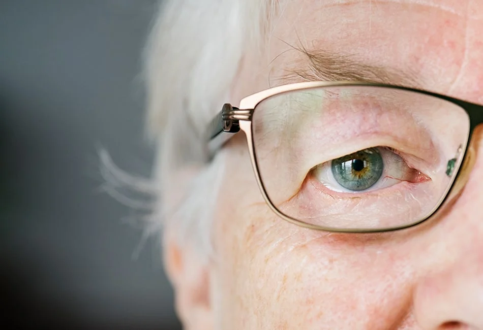 Cataract Surgery
