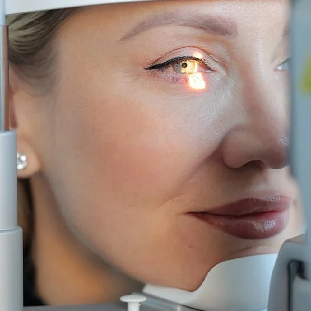 Refractive Lens Exchange (RLE)