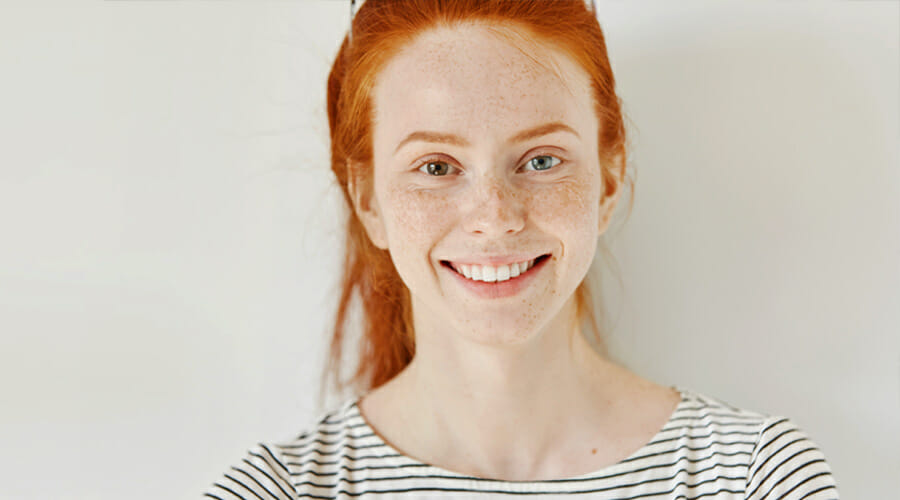 A ginger woman with heterochromia (different coloured eyes) staring at the camera and laughing