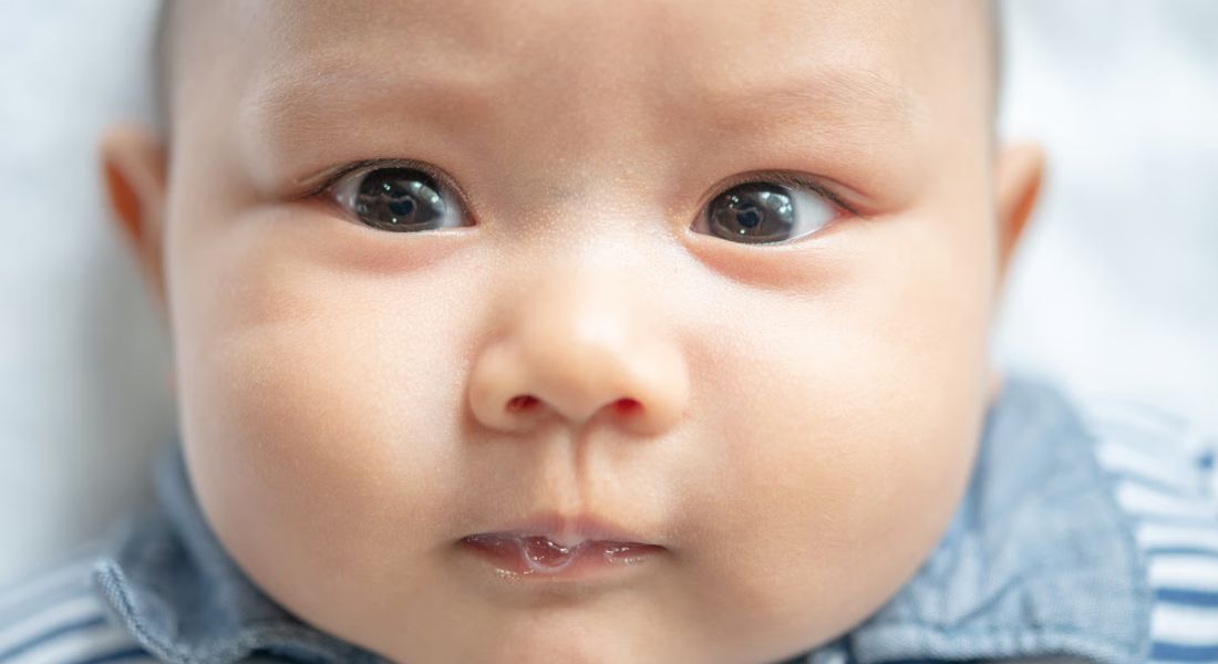 Watery Eyes in Babies and Children_ Blocked Tear Duct or Something Else
