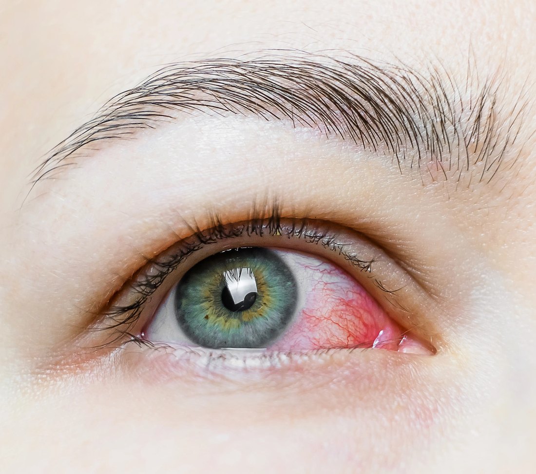 Close-up of the eye and brow