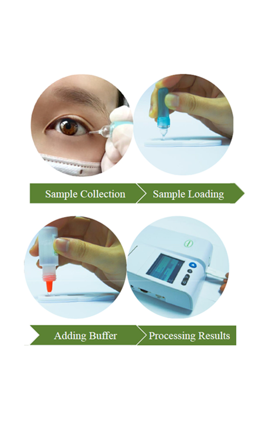 Tear Biomarker Testing